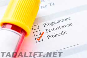 prolactin testing